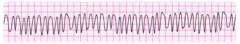 Give an immediate unsynchronized high-energy shock (defibrillation dose).