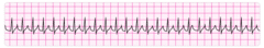 Perform vagal maneuvers