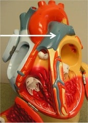 pulmonary trunk