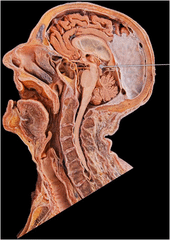 pineal gland