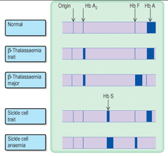 Thalassemia electrophoresis