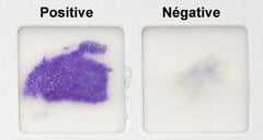 Two different bacterial samples, A and B, were tested with an Oxidase dry slide. This is a picture of the test results. Select ALL appropriate statements regarding the pictured Oxidase test results.