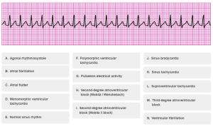 ACLS Precourse Self Assessment Answers » Quizzma