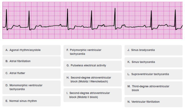 ACLS Precourse Self Assessment Answers » ACLS Pre Test Answers