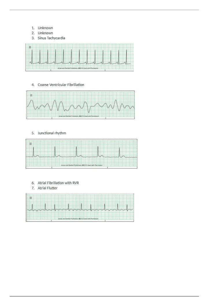 Relias Dysrhythmia Basic B