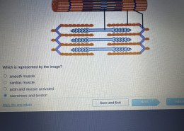 Which muscle type is represented by the image?